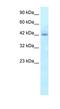 Regulator Of G Protein Signaling 20 antibody, NBP1-54839, Novus Biologicals, Western Blot image 