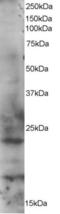 Ras-related protein Rab-2A antibody, LS-C55351, Lifespan Biosciences, Western Blot image 