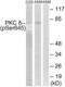 Protein Kinase C Delta antibody, LS-C117458, Lifespan Biosciences, Western Blot image 