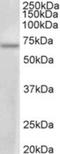 Protein Arginine Methyltransferase 3 antibody, NBP2-26133, Novus Biologicals, Western Blot image 