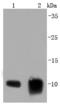 S100 Calcium Binding Protein A6 antibody, A02043S100, Boster Biological Technology, Western Blot image 