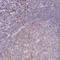 Zinc Finger And BTB Domain Containing 6 antibody, NBP2-49116, Novus Biologicals, Immunohistochemistry paraffin image 