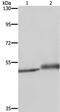 Mig6 antibody, PA5-50708, Invitrogen Antibodies, Western Blot image 