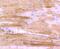 Actin Alpha 1, Skeletal Muscle antibody, NBP2-67907, Novus Biologicals, Immunohistochemistry paraffin image 