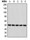 Pantothenate Kinase 2 antibody, LS-C353561, Lifespan Biosciences, Western Blot image 