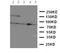 Neurotrophic Receptor Tyrosine Kinase 3 antibody, LS-C313123, Lifespan Biosciences, Western Blot image 