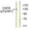 Colony Stimulating Factor 1 Receptor antibody, LS-C198848, Lifespan Biosciences, Western Blot image 