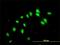 Chromosome 17 Open Reading Frame 75 antibody, H00064149-M01, Novus Biologicals, Immunofluorescence image 