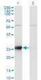 Thymidine Kinase 1 antibody, H00007083-M11, Novus Biologicals, Western Blot image 