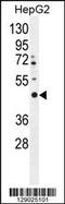 Leucine Rich Repeats And Transmembrane Domains 2 antibody, MBS9202843, MyBioSource, Western Blot image 