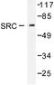 SRC Proto-Oncogene, Non-Receptor Tyrosine Kinase antibody, LS-C176214, Lifespan Biosciences, Western Blot image 