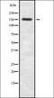 Tensin 2 antibody, orb337419, Biorbyt, Western Blot image 