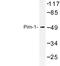 Pim-1 Proto-Oncogene, Serine/Threonine Kinase antibody, LS-C177322, Lifespan Biosciences, Western Blot image 