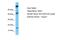 Succinate Dehydrogenase Complex Subunit C antibody, PA5-45466, Invitrogen Antibodies, Western Blot image 