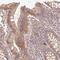 RAS Like Proto-Oncogene B antibody, NBP2-46872, Novus Biologicals, Immunohistochemistry paraffin image 