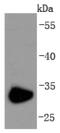 CD74 Molecule antibody, A01340-1, Boster Biological Technology, Western Blot image 