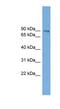 UTP14A Small Subunit Processome Component antibody, NBP1-56964, Novus Biologicals, Western Blot image 