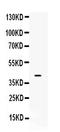 Melanocortin 2 Receptor antibody, A02306-1, Boster Biological Technology, Western Blot image 