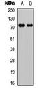 DEAD-Box Helicase 3 X-Linked antibody, LS-C358966, Lifespan Biosciences, Western Blot image 