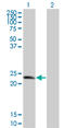 Tumor protein D52 antibody, LS-C198360, Lifespan Biosciences, Western Blot image 