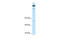 Timeless Circadian Regulator antibody, 28-025, ProSci, Western Blot image 