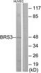 Bombesin Receptor Subtype 3 antibody, TA313526, Origene, Western Blot image 