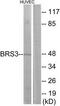 Bombesin Receptor Subtype 3 antibody, TA313526, Origene, Western Blot image 