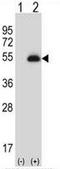 Paired box protein Pax-6 antibody, AP53180PU-N, Origene, Western Blot image 