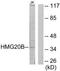 High Mobility Group 20B antibody, TA315047, Origene, Western Blot image 