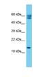 Chromosome 12 Open Reading Frame 65 antibody, orb326729, Biorbyt, Western Blot image 
