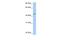 Patatin Like Phospholipase Domain Containing 5 antibody, PA5-69566, Invitrogen Antibodies, Western Blot image 