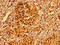 Alpha And Gamma Adaptin Binding Protein antibody, LS-C673193, Lifespan Biosciences, Immunohistochemistry paraffin image 