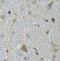 N-chimaerin antibody, FNab01663, FineTest, Immunohistochemistry paraffin image 