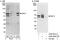 Dyskerin Pseudouridine Synthase 1 antibody, A302-592A, Bethyl Labs, Western Blot image 