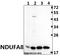 NADH:Ubiquinone Oxidoreductase Subunit A8 antibody, A10547-1, Boster Biological Technology, Western Blot image 