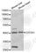 General Transcription Factor IIA Subunit 1 antibody, A5345, ABclonal Technology, Western Blot image 