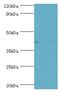 Serpin Family B Member 5 antibody, MBS968785, MyBioSource, Western Blot image 