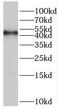 Origin Recognition Complex Subunit 4 antibody, FNab06007, FineTest, Western Blot image 