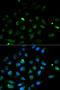 Perforin 1 antibody, STJ25109, St John