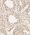 Methyltransferase Like 14 antibody, M07389, Boster Biological Technology, Immunohistochemistry paraffin image 