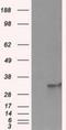 Fumarylacetoacetate Hydrolase Domain Containing 2A antibody, NBP2-02331, Novus Biologicals, Western Blot image 