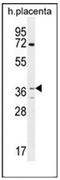 Olfactory Receptor Family 2 Subfamily AT Member 4 antibody, AP53027PU-N, Origene, Western Blot image 