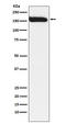 Nuclear Receptor Coactivator 1 antibody, M00856, Boster Biological Technology, Western Blot image 