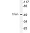 Tryptophan Hydroxylase 1 antibody, LS-C177761, Lifespan Biosciences, Western Blot image 