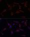 Cellular Communication Network Factor 2 antibody, LS-C746876, Lifespan Biosciences, Immunofluorescence image 