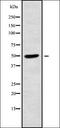 Insulin Like Growth Factor Binding Protein 6 antibody, orb337755, Biorbyt, Western Blot image 