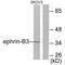 Ephrin B3 antibody, A04098, Boster Biological Technology, Western Blot image 