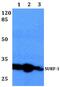 SURF1 Cytochrome C Oxidase Assembly Factor antibody, PA5-36198, Invitrogen Antibodies, Western Blot image 