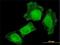 T Cell Lymphoma Invasion And Metastasis 2 antibody, H00026230-M01, Novus Biologicals, Immunofluorescence image 