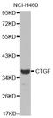 Cellular Communication Network Factor 2 antibody, STJ111264, St John